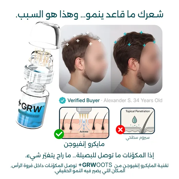 Publicité GRWOOTS sur les follicules obstrués en arabe par Mira Visions, composée de droite à gauche