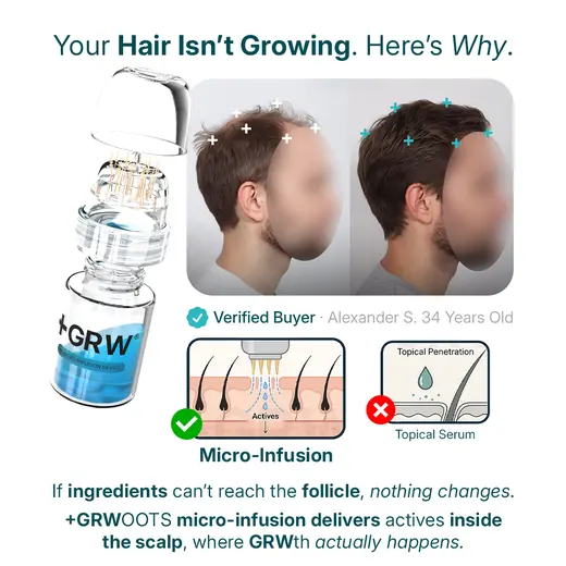 Publicité explicative GRWOOTS sur les follicules obstrués par Mira Visions