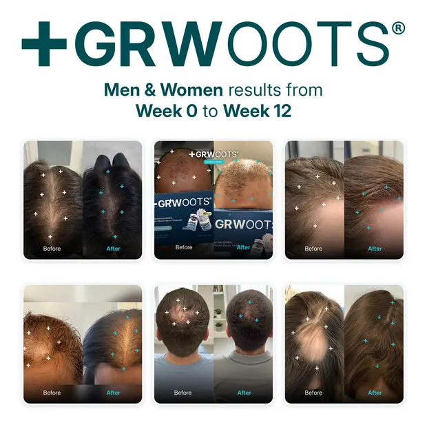 Grille de résultats GRWOOTS, six utilisateurs de la semaine zéro à la semaine douze, mise en page par Mira Visions